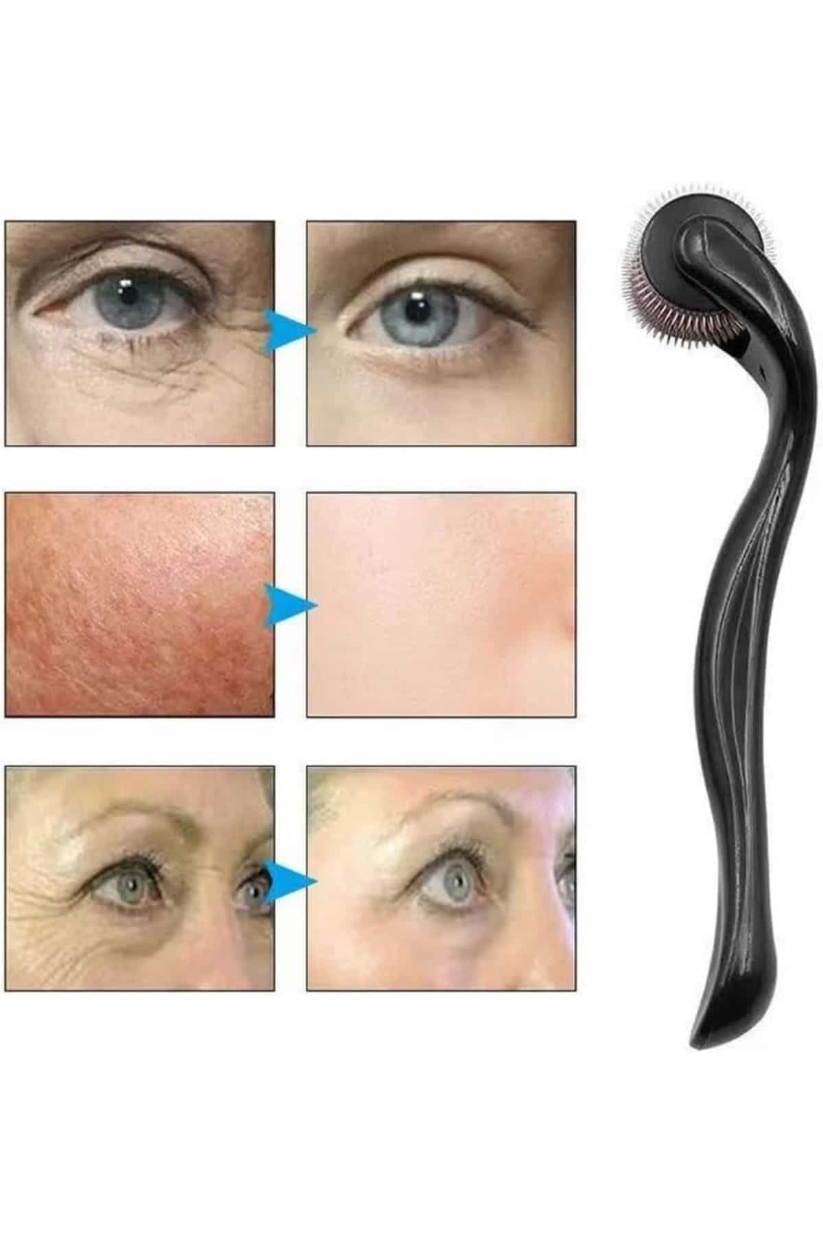 Dermaroller Titanyum 540 Iğneli 1 Mm Saç Kaş Sakal Serum Kullanıma Uygun 4