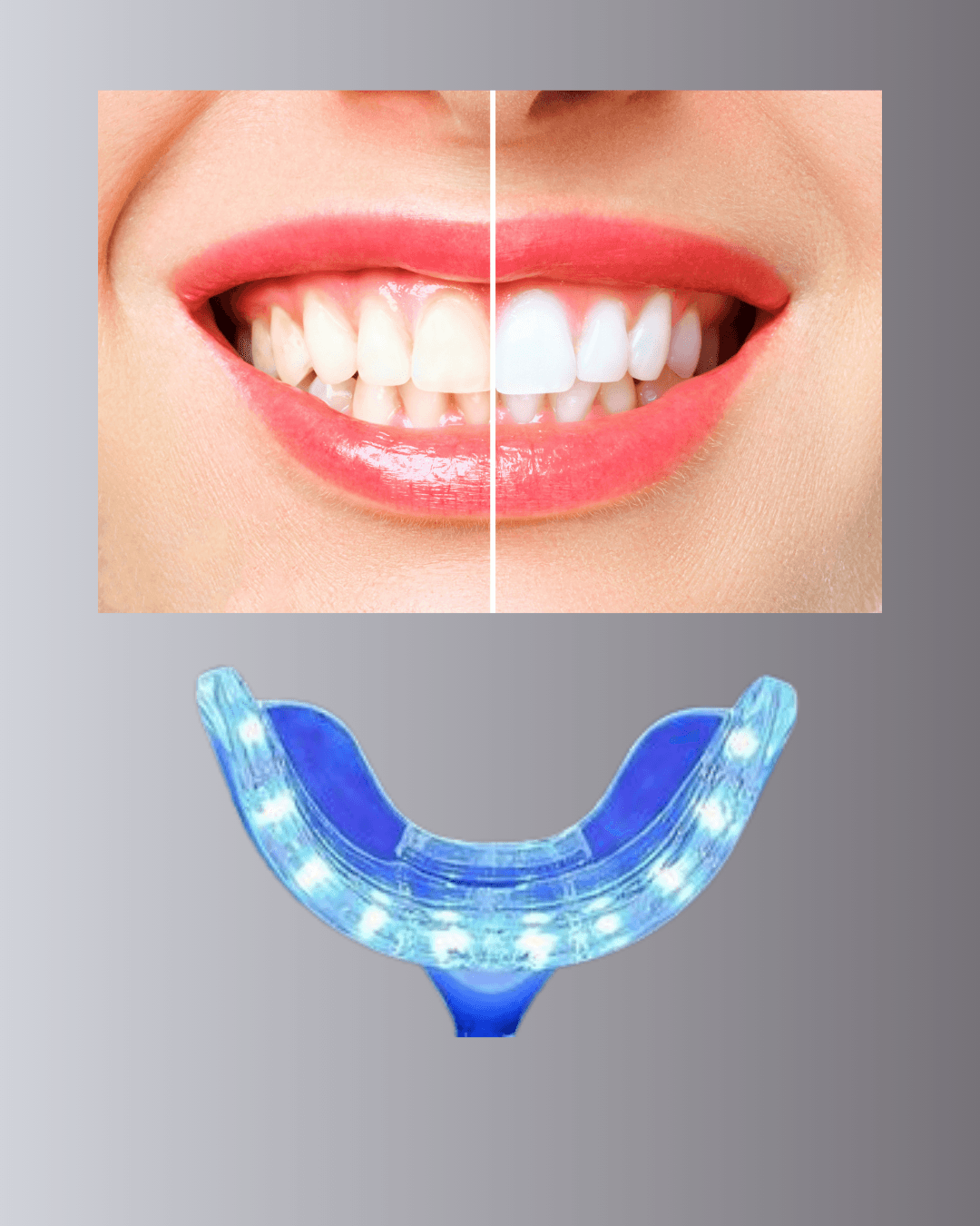 LED Işıklı Profesyonel Diş Beyazlatma Seti 3