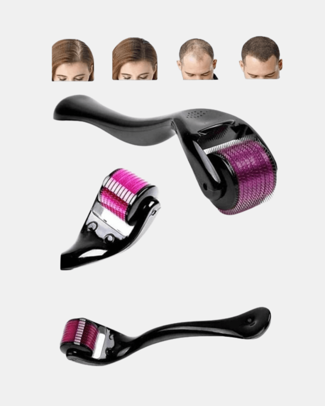 Derma Roller Titanyum İğneli Cilt Yenileyici – Akne ve Kırışıklık Karşıtı 4